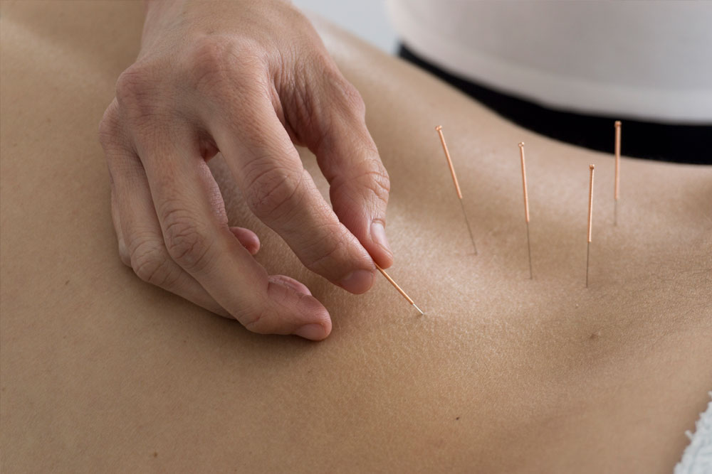 vendaje neuromuscular sevilla gines