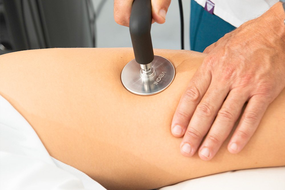 fisioestetica Indiba Piernas Sevilla Gines